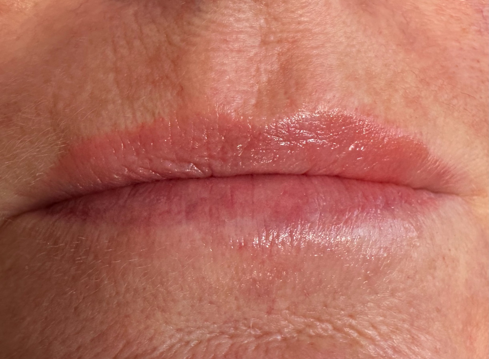 Soft natural healed lip blush result by Sigil and Skin Sunderland